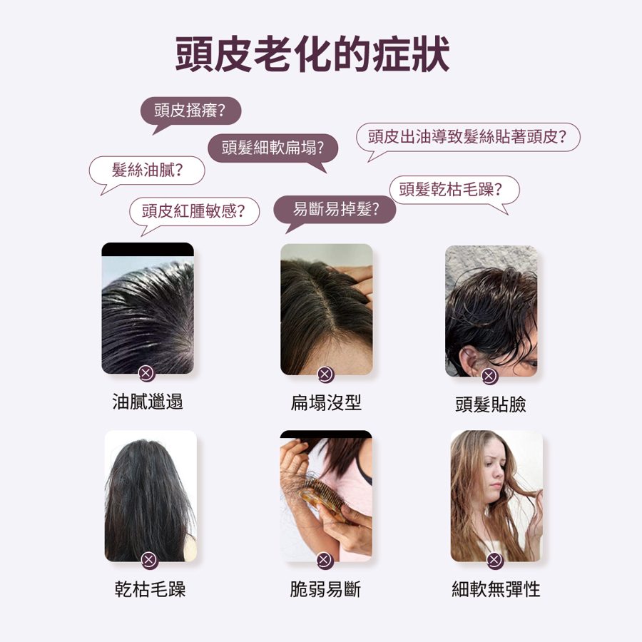 頭皮老化的症狀